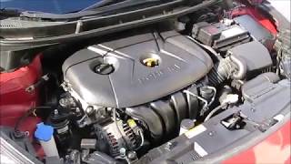 How To Fix Hyundai Elantra Engine Ticking Noise VERY EASY